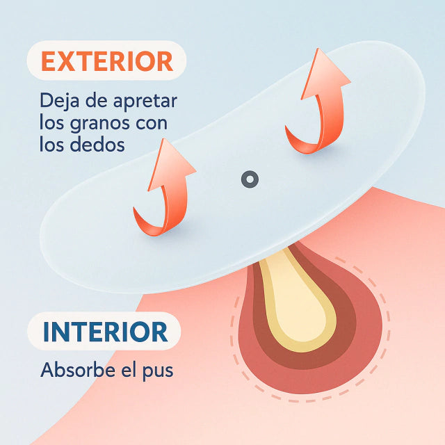 Parches Anti Acné - Solución definitiva x48 unidades